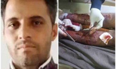 प्रदेश में गुंडागर्दी चरम पर शराब माफिया की शिकायत की तो बुरी तरह से पीटा हाथ और पांव में कीले ठोकी 